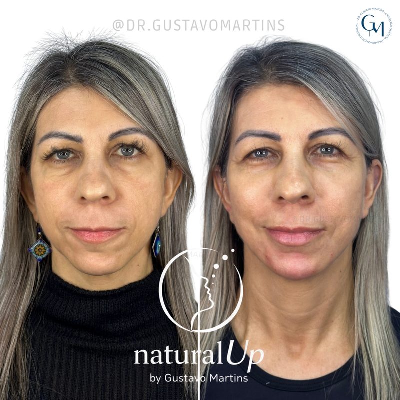 Caso clínico antes e depois 7