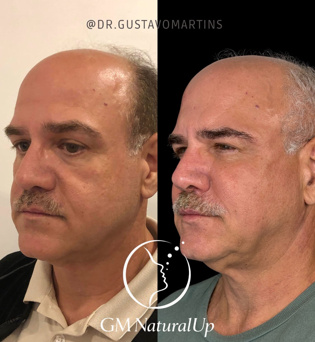 Caso clínico antes e depois 12